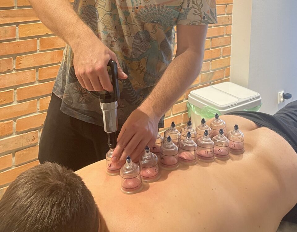 bańki chińskie, terapia manualna, Opalenica