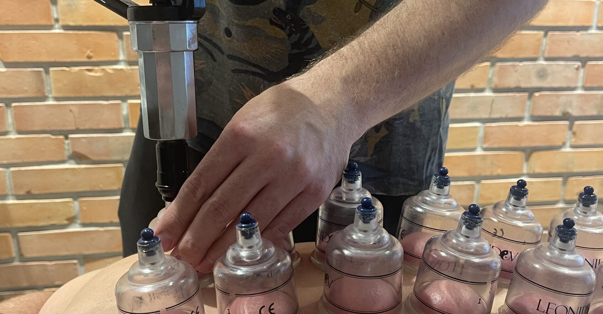 bańki chińskie, terapia manualna, Opalenica