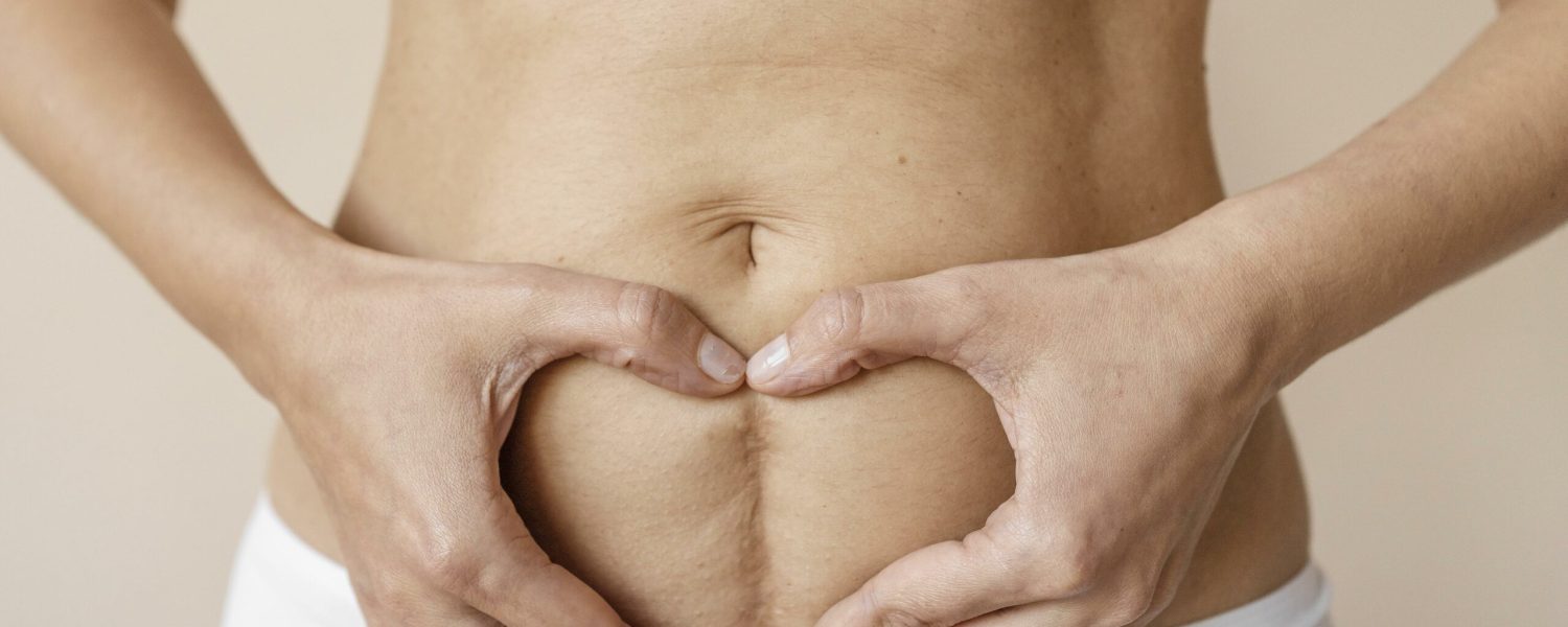 mobilizacja blizny, fizjoterapia uroginekologiczna